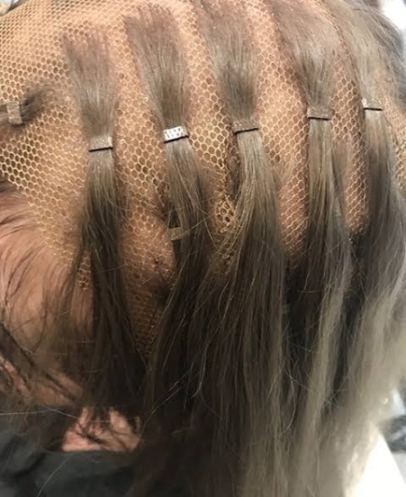 Hair Loss Integration